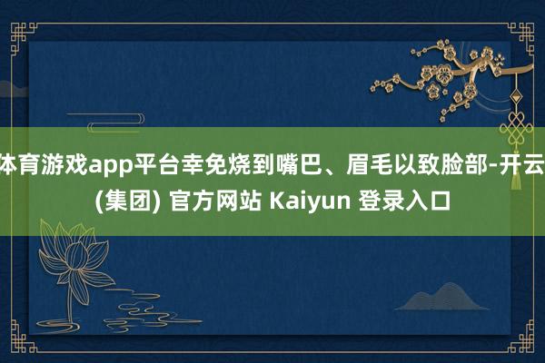 体育游戏app平台幸免烧到嘴巴、眉毛以致脸部-开云 (集团) 官方网站 Kaiyun 登录入口